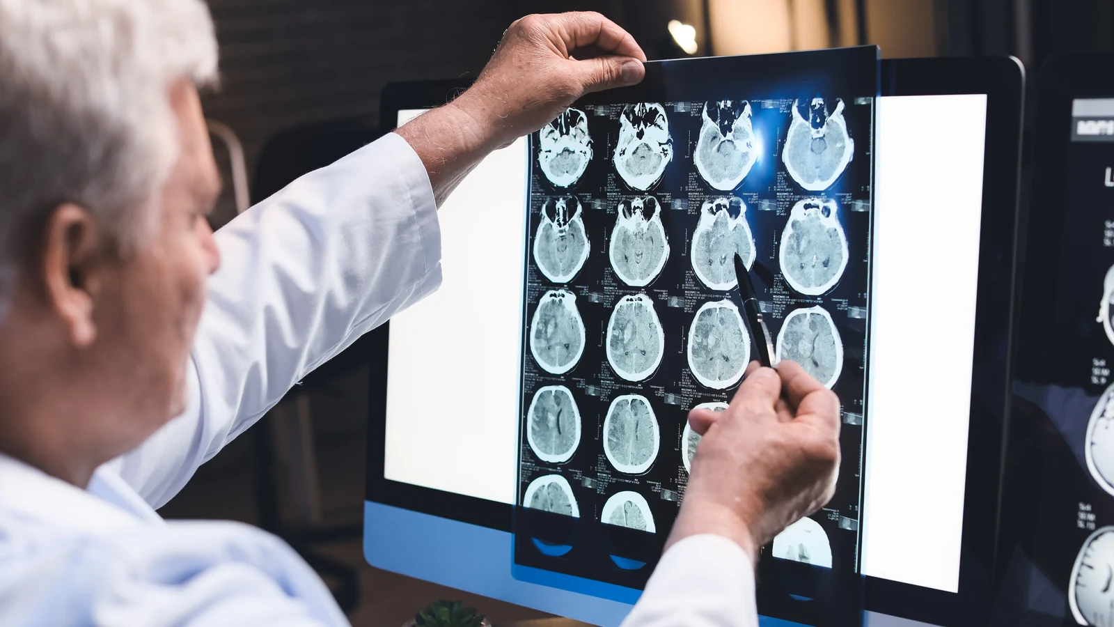 Médico de jaleco branco examinando cortes de tomografia de crânio contra a tela do consultório, apontando uma imagem com a caneta.